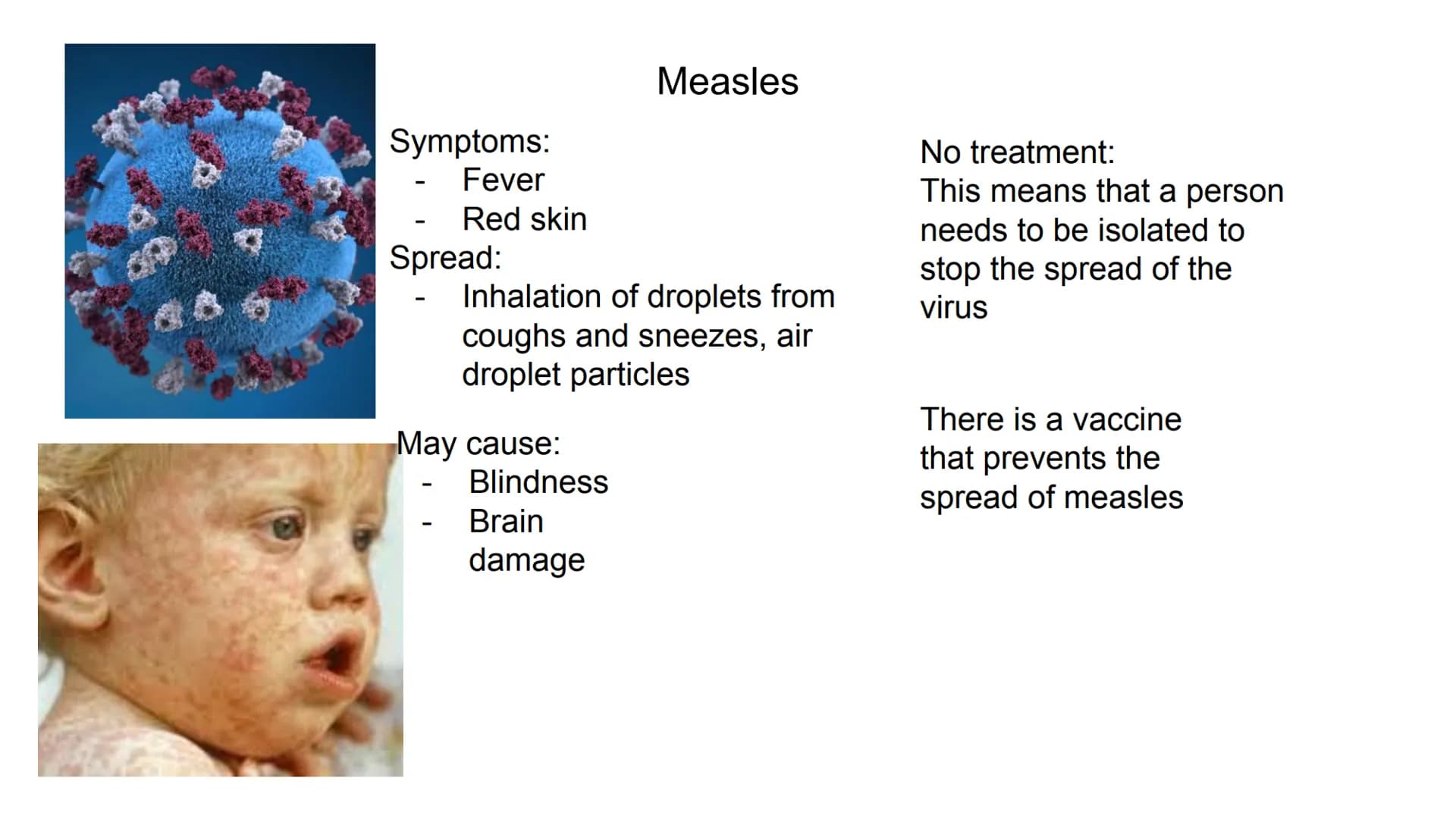 Symptoms:
Fever
Red skin
-
Spread:
May cause:
-
-
Inhalation of droplets from
coughs and sneezes, air
droplet particles
Blindness
Measles
Br