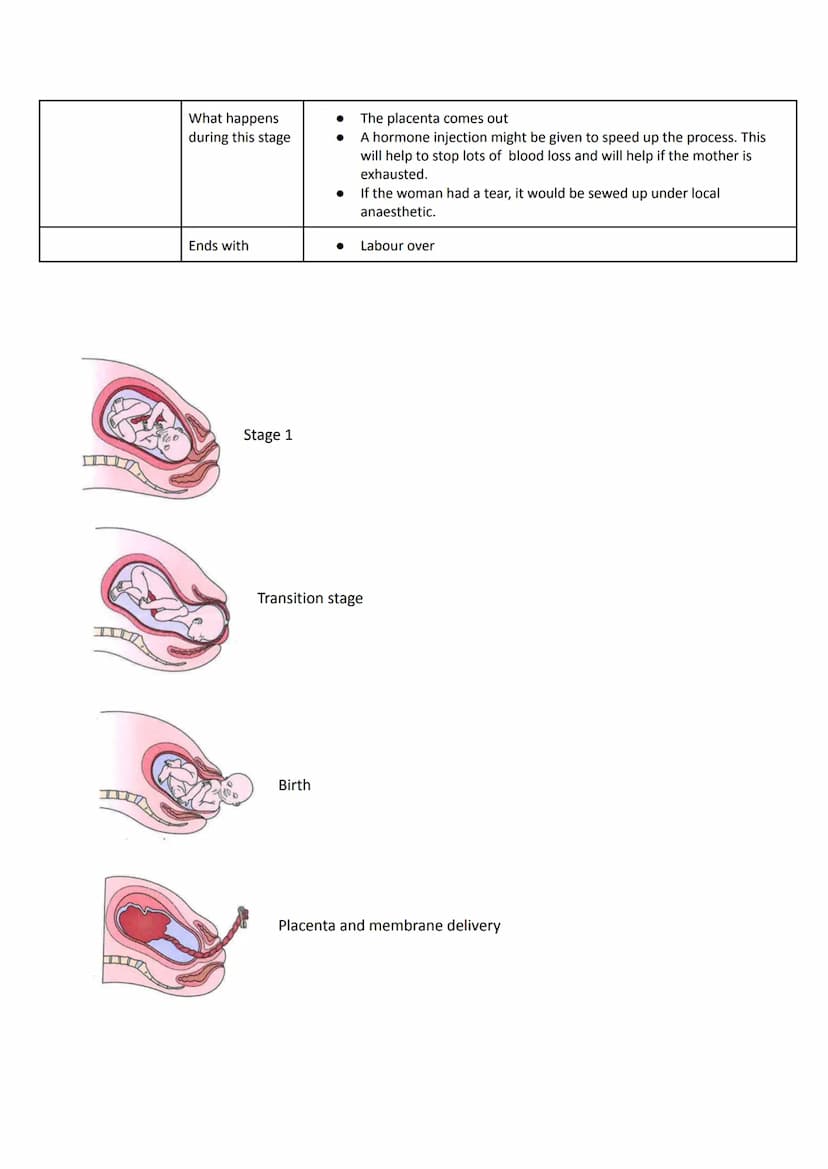 Labour and birth
Signs of labour:
●
Stage 1: Labour
Stage 2:
Birth of Baby
Your water breaks.
Contractions - sometimes you can get contracti