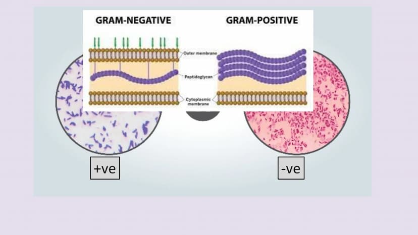 3.2.1.2 Structure of prokaryotic cells and of viruses
Content
Prokaryotic cells are much smaller than eukaryotic cells. They also
differ fro