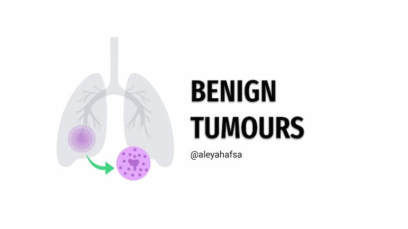CANCERS AND
TUMOURS BENIGN
TUMOURS
@aleyahafsa What is a tumour?
A tumour is a lump or growth of
tissue made up from abnormal cells.
Tumours