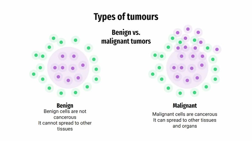 CANCERS AND
TUMOURS BENIGN
TUMOURS
@aleyahafsa What is a tumour?
A tumour is a lump or growth of
tissue made up from abnormal cells.
Tumours