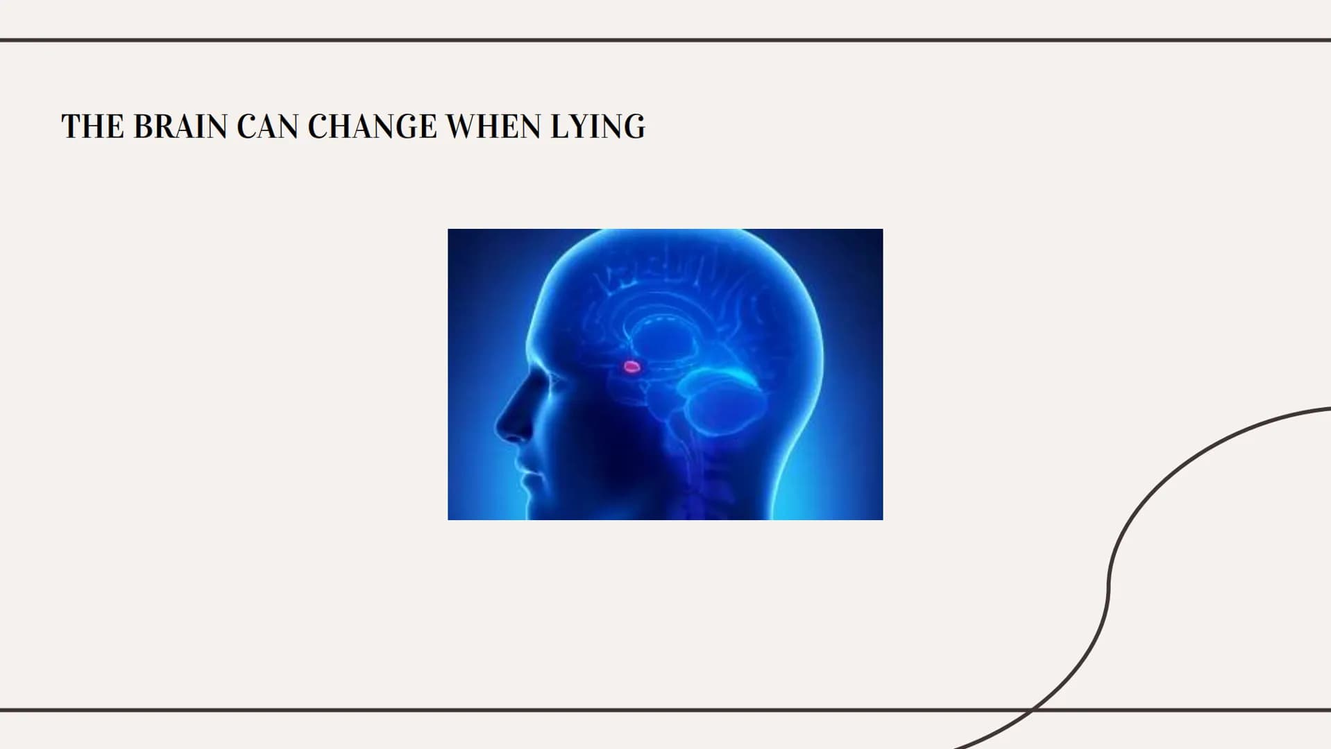 THE TRUTHS OF LYING 01
WHAT IS LYING?
Types Of Lies
Effects on the brain Types of lies
01
White
04
Plastic Trophy
02
Concealment
05
Puppetee