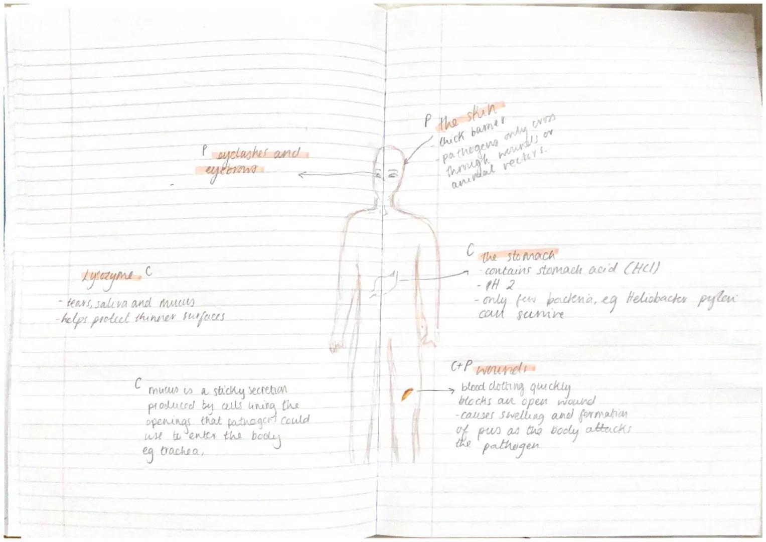 Cardiovascular disease
8/12/2022
What is cardiovascular disease and how is it
treated?
Substances from tobacco smoke damage the
artery linin