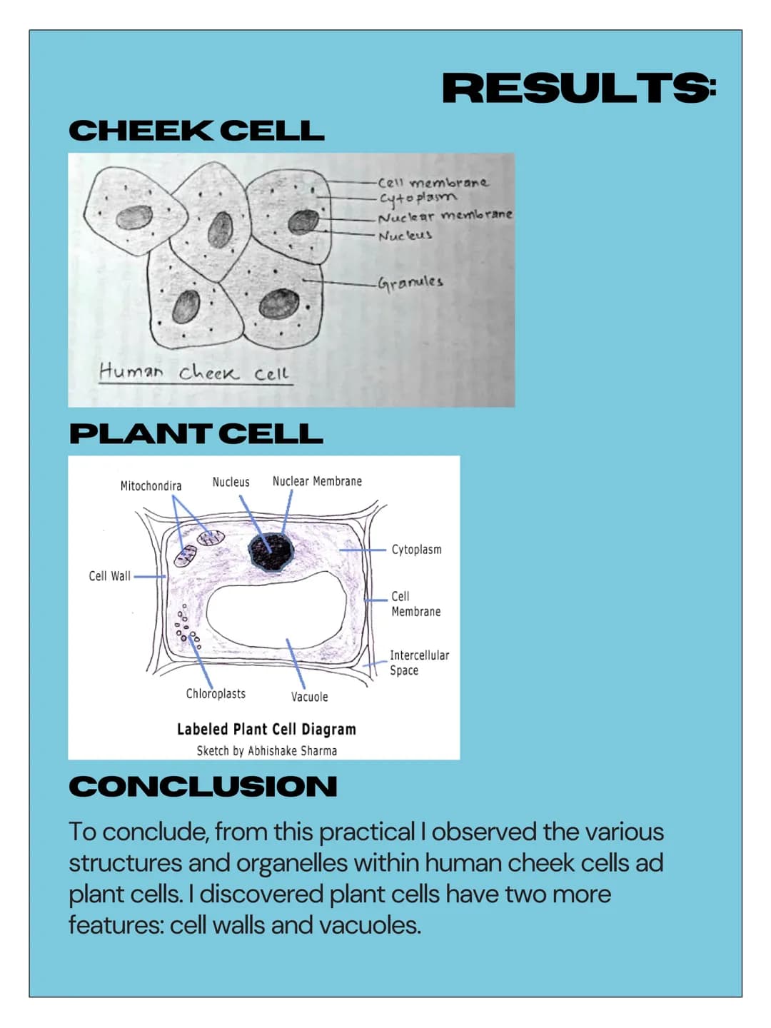 4.1 CELL
BIOLOGY
EUKARYOTES
PROKARYOTES
AND
- 4.1.1.1
Eukaryotic Cells
• Have a cell membrane
Have cytoplasm
• Genetic material is stored in