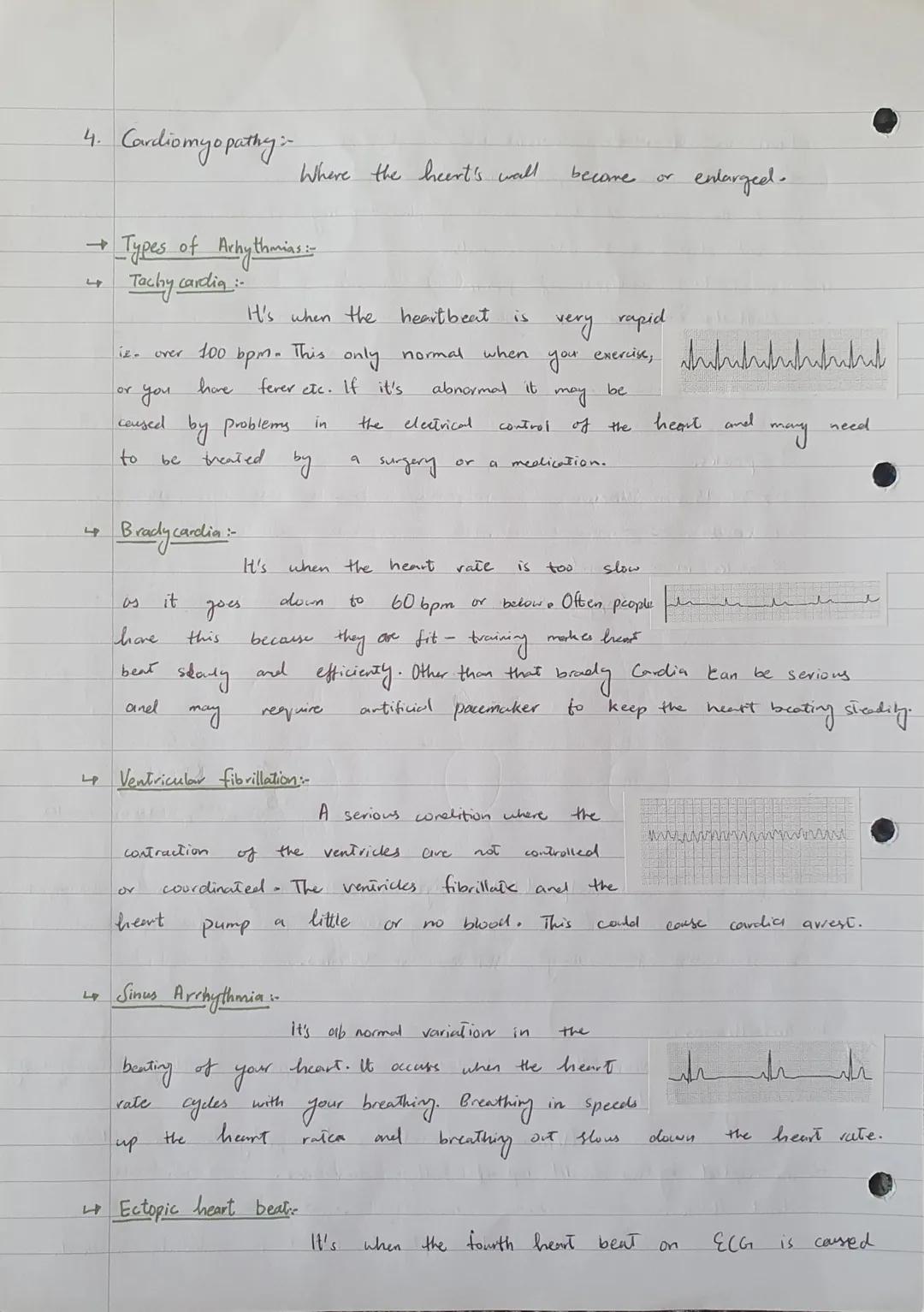 UNIT 5
Cardiac
The Structure of heart...
The human
on top and
two
thick walled Ventricles at the
heart has four chambers. Two Atvias
bottom.