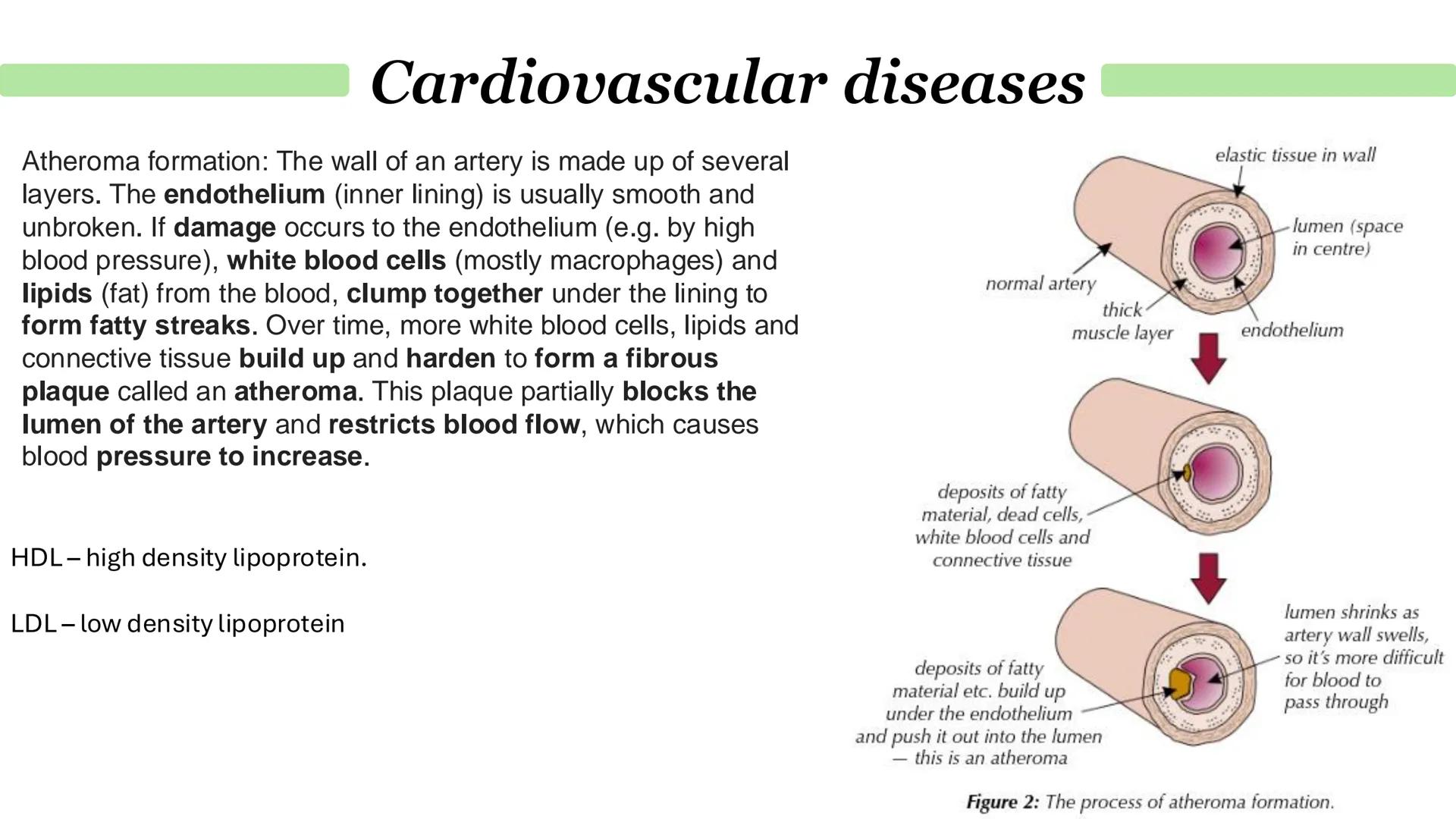 # Cardiovascular diseases
The cause of coronary heart disease (CHD).
1. Layers of fatty material build up inside coronary arteries (vessels